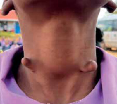 Fig. 4, follow-up 2022